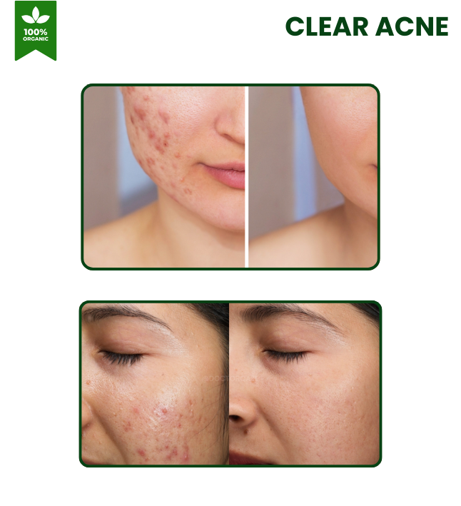 TEA TREE FACE WASH-150ml - Image 3